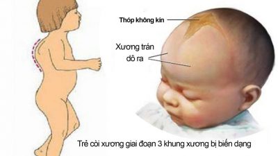 nhiều hệ lụy