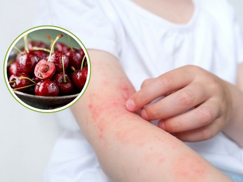 giai-dap-an-cherry-co-nong-khong