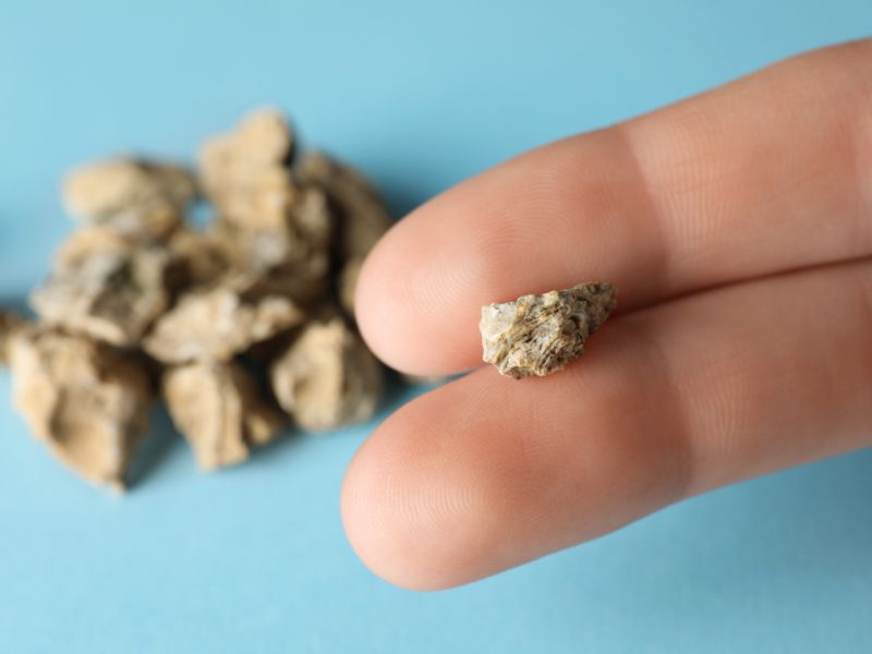 ca-chua-ky-gi-bac-si