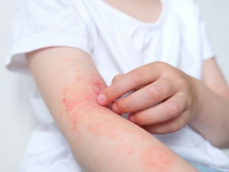 tra-loi-khoai-so-ky-voi-gi