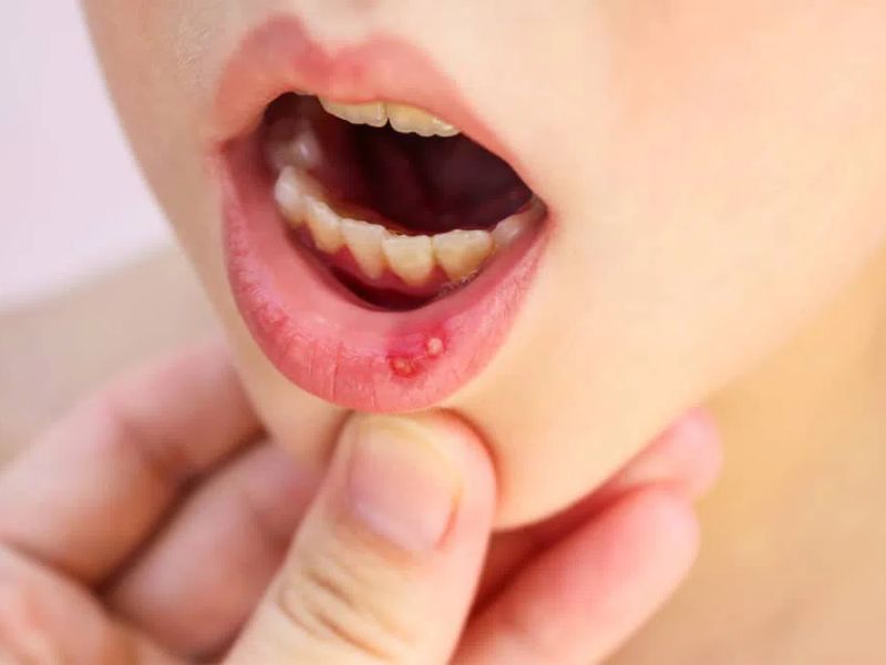 bat-mi-dua-hau-ky-voi-gi