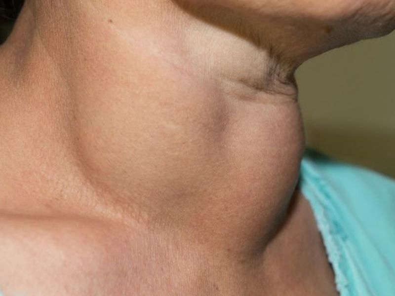 ban-khoan-cu-cai-trang-ky-gi