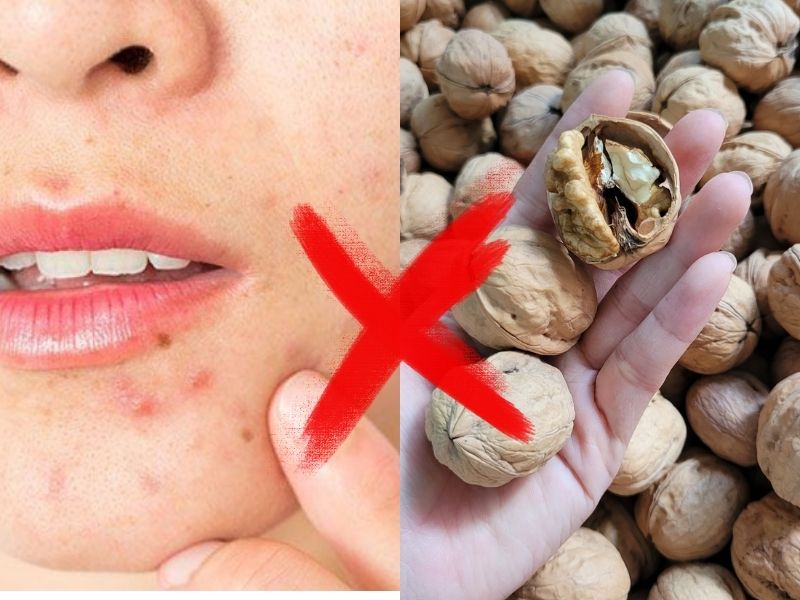 bat-mi-qua-oc-cho-ky-voi-gi